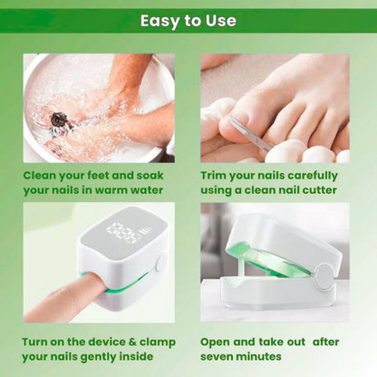 TrindingOnline™ - Nail Fungus Laser