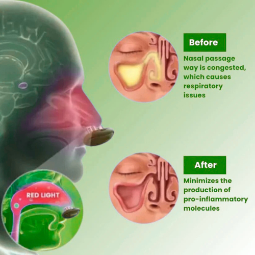 TrindingOnline™ - Comfortable Nasal Solution